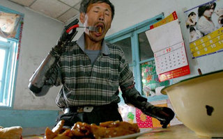 Iron man from China | 8 years ago, a resident of China’s Jilin Province has decided to build a homemade bomb, to go fishing. As a result of an accidental explosion he lost both hands.