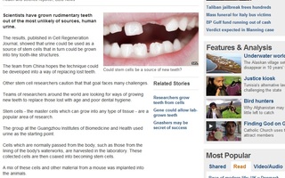 Uusia hampaita virtsasta tuotettujen kantasolujen avulla? | Vaikka professori Chris Mason University College Londonista kritisoikin hanketta, tämä on silti jännä tutkimus :)