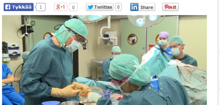 Hollantilainen sairaala asensi potilaalle 3D-tulostetun pääkallon puolikkaan